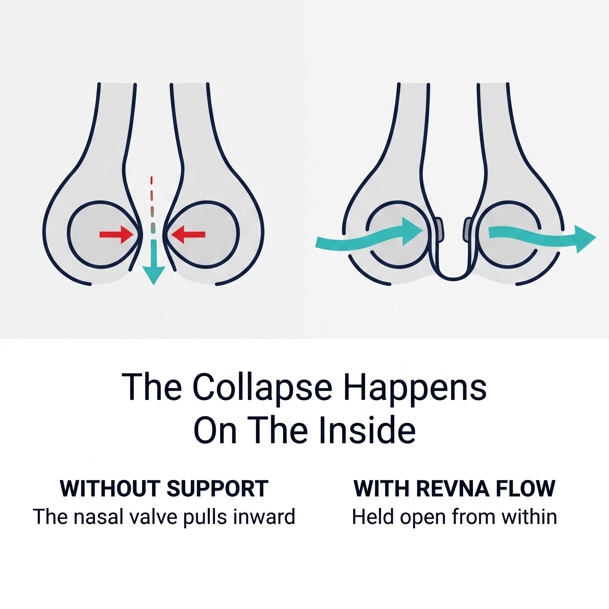 REVNA Flow™ (2 Sizes)